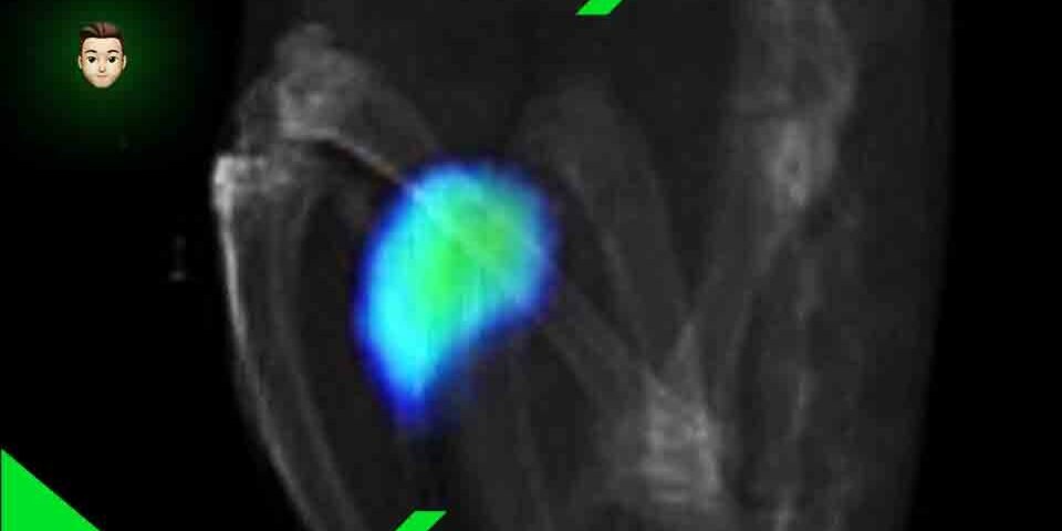 Nanorobot si muovono nell'organismo di topi vivi (Video)
