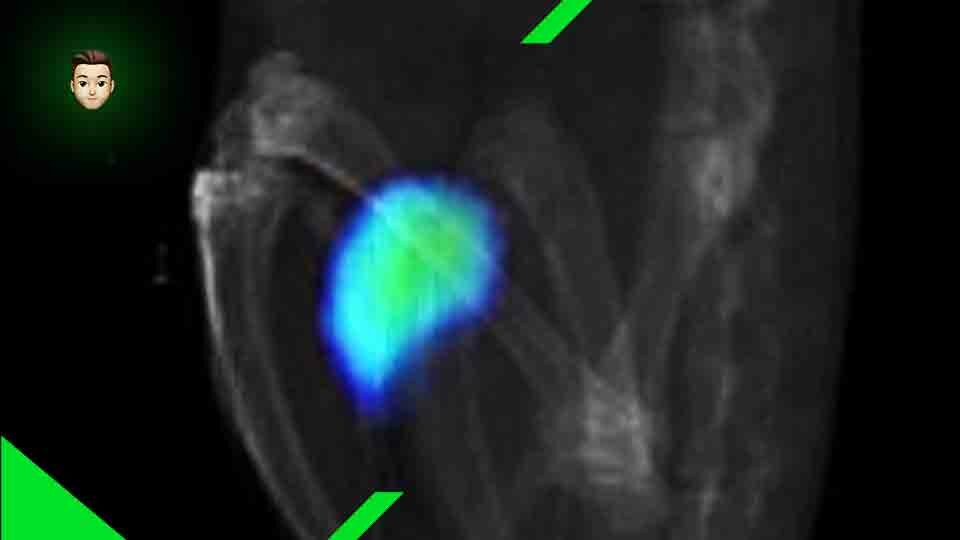 Nanorobot si muovono nell'organismo di topi vivi (Video)