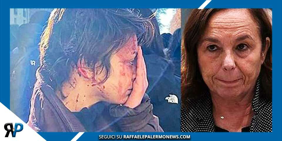 Polizia manganella studenti: “Manganellate anche dopo che mi avevano aperto la testa”